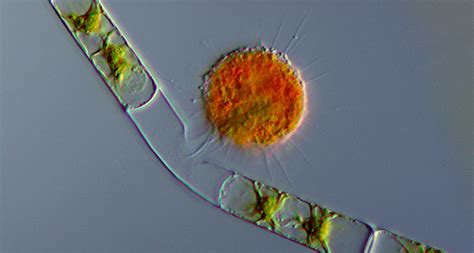  フゾオア - 驚異の変形能力を持つ単細胞生物！